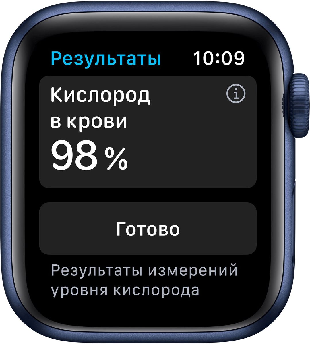 Apple Watch Series 6 GPS, 40 mm, алюминий темно-синий, спортивный ремешок цвета «тёмный ультрамарин»— фото №2